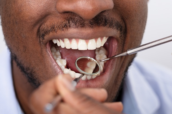 What is Full Mouth Reconstruction?