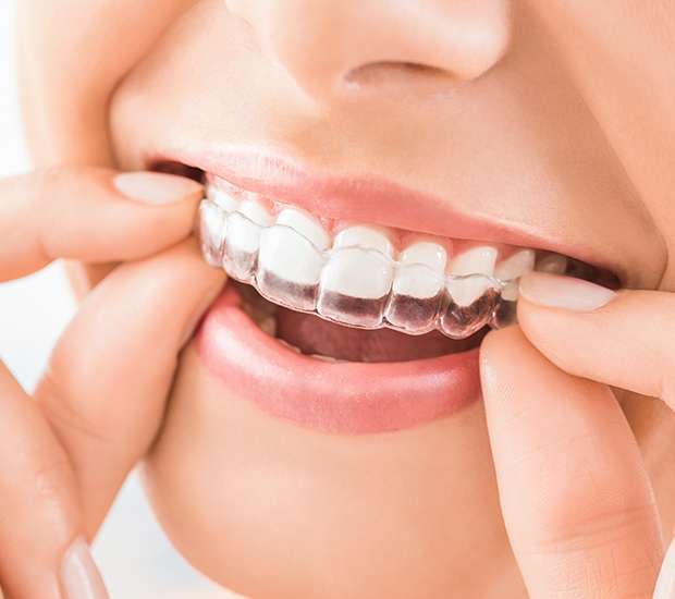 North Hollywood Does Invisalign Really Work